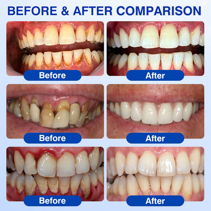 👨‍⚕️✅🦷Slimpatche® GumRevive Periodontal Repair Gel
