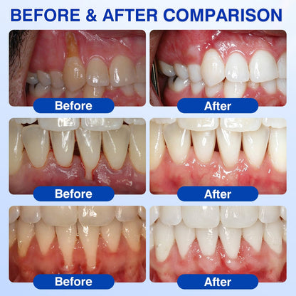 👨‍⚕️✅🦷Slimpatche® GumRevive Periodontal Repair Gel