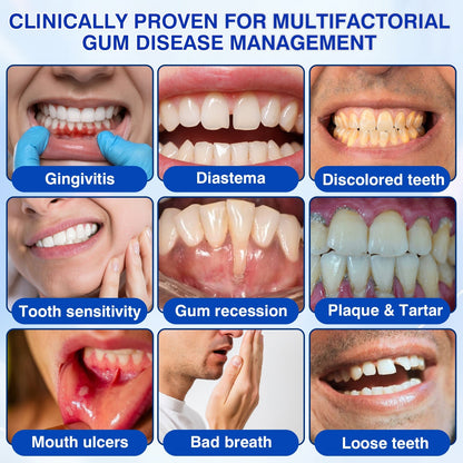 👨‍⚕️✅🦷Slimpatche® GumRevive Periodontal Repair Gel