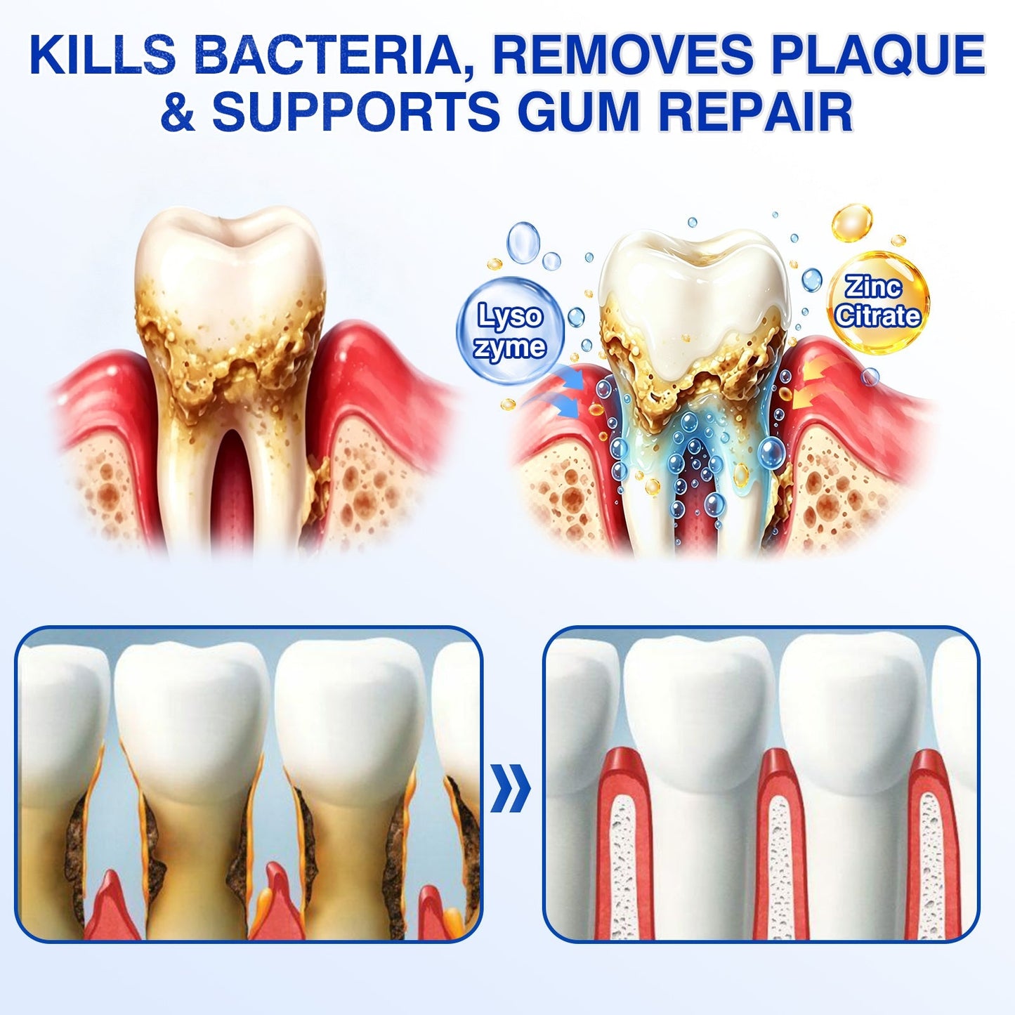 👨‍⚕️✅🦷Slimpatche® GumRevive Periodontal Repair Gel